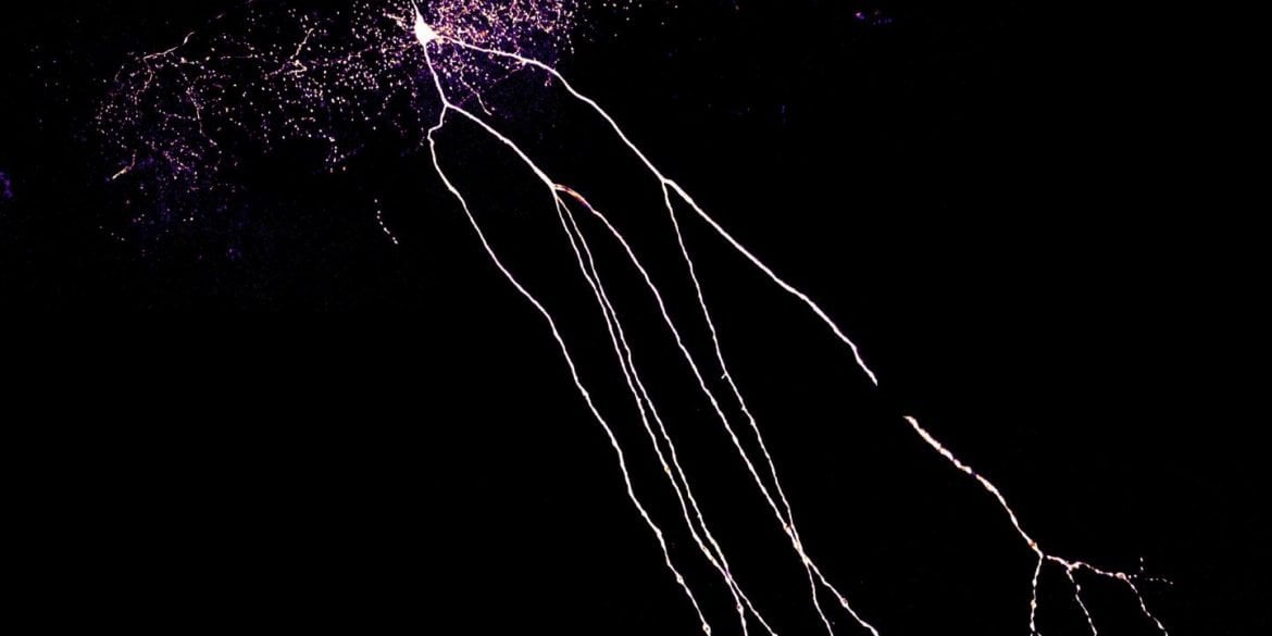 this shows a neuron