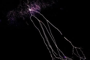 this shows a neuron