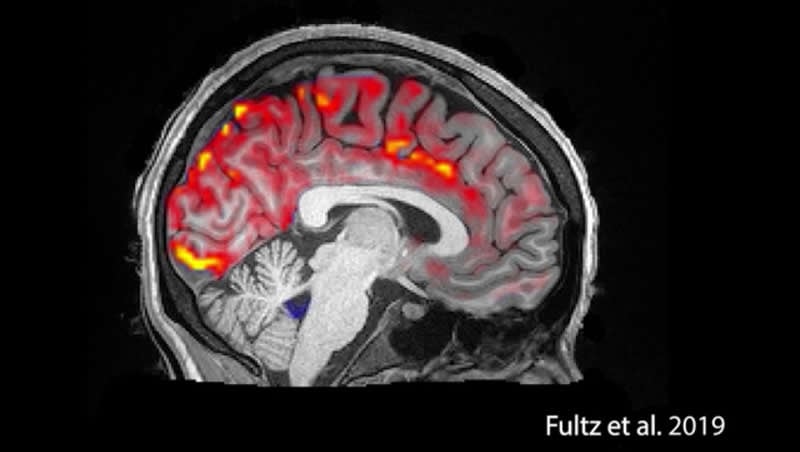 This shows the CSF in the brain during sleep