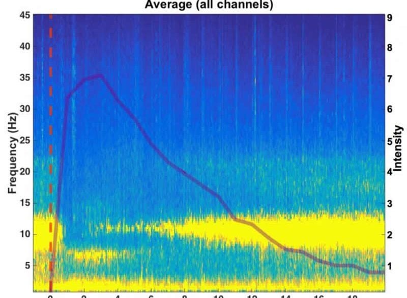 This shows an EEG readout from the study