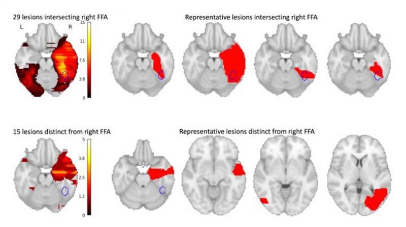 This shows brain scans from the study