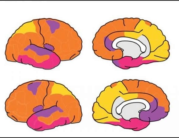 This is a diagram of the brain