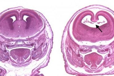 This shows fetal brain scans