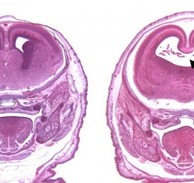 This shows fetal brain scans