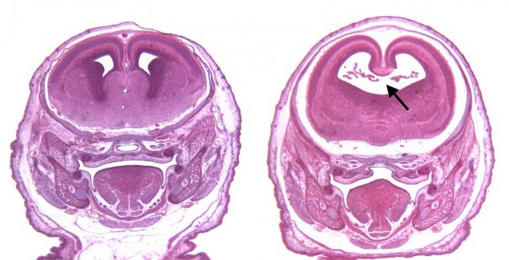 This shows fetal brain scans