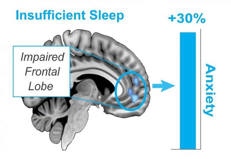 Stressed to the max? Deep sleep can rewire the anxious brain