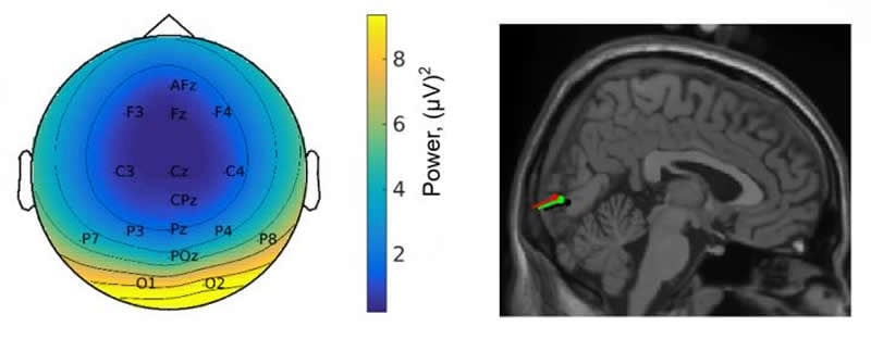 This shows the EEG read out and brain scan