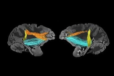 This shows the location of the PITd in the brain