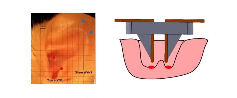 This is a diagram of an ear