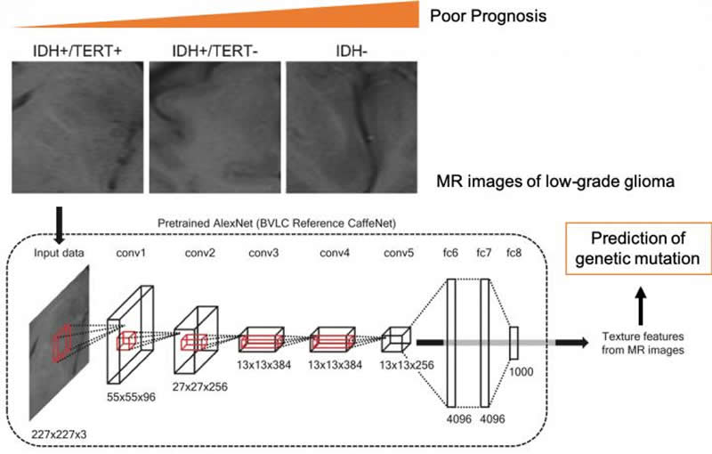 This shows how the CNN analyzes the MRI brain cancer data