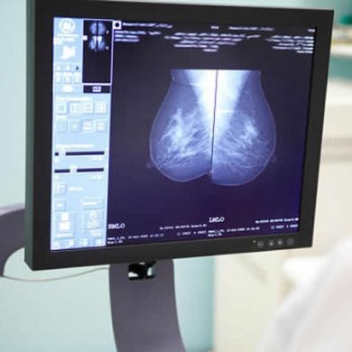 This shows a doctor looking at a breast cancer scan