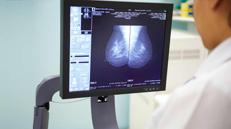 This shows a doctor looking at a breast cancer scan