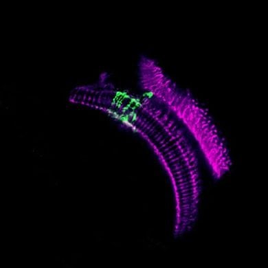 This shows neurons in the fly visual cortex