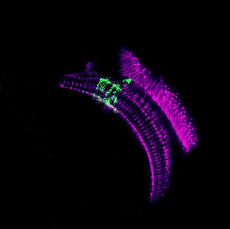 Blue Light Harms Fruit Fly Eyes and Brains - Natural Eye Care Blog