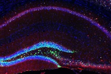 This is a hippocampal brain slice