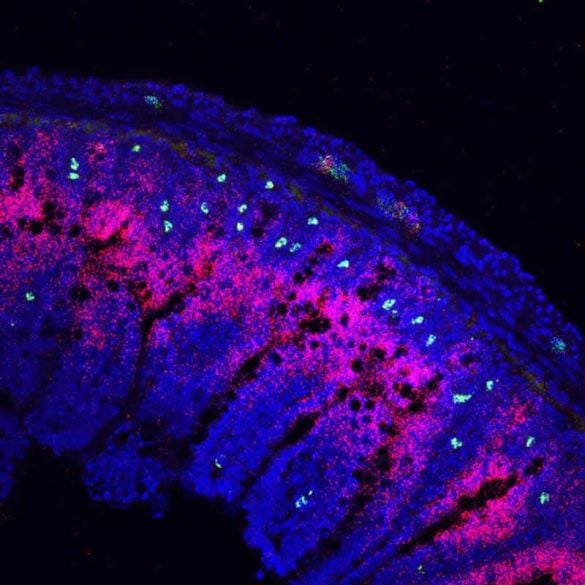 This shows he intestines