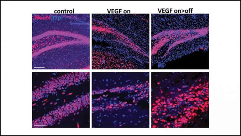 This shows DG brain slices