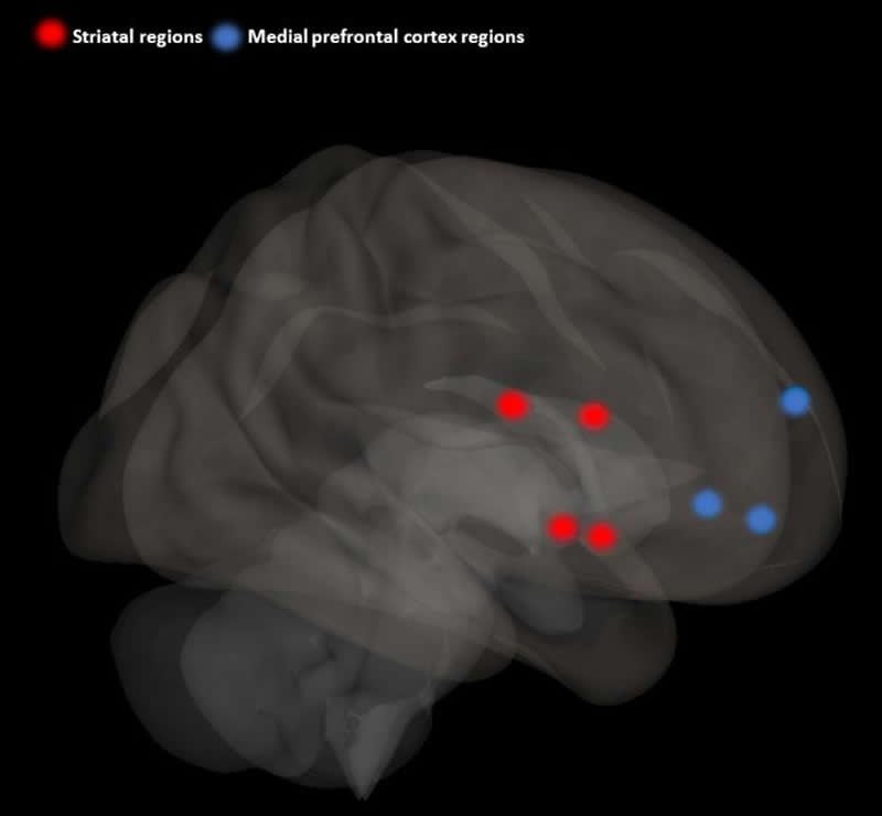 This shows the mPFC and striatum highligted on a brain scan