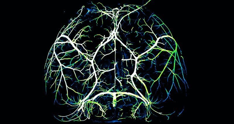 This shows arteries in a mouse brain