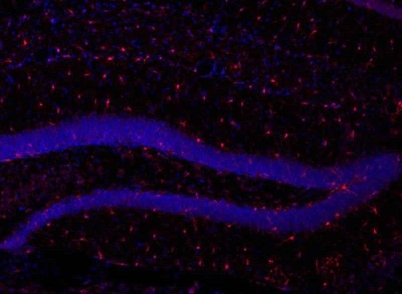 This shows microglia