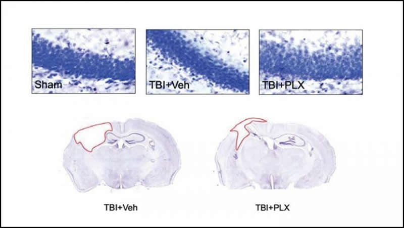 This shows brain slices from the research paper