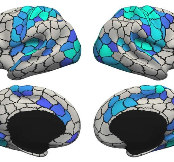 This shows brain scans from the study