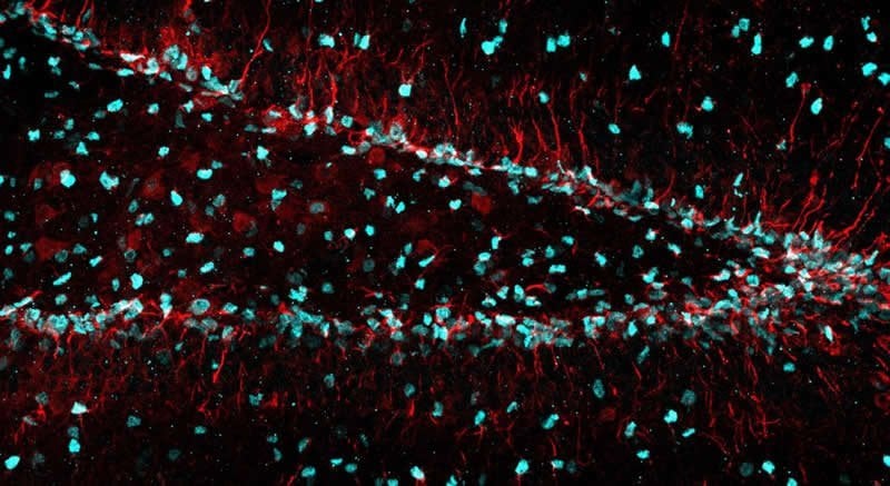 This shows hippocampal neurons