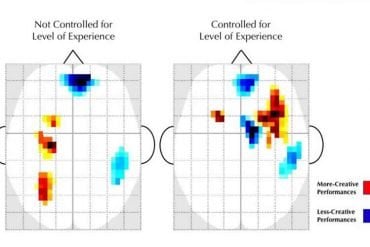 This shows EEG printouts from the study