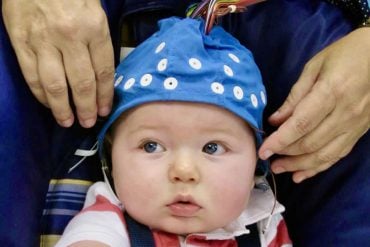 This shows a baby in an EEG cap