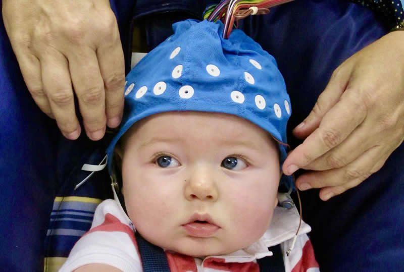 This shows a baby in an EEG cap