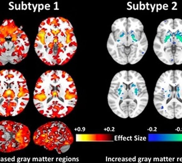 This shows brain scans from the study