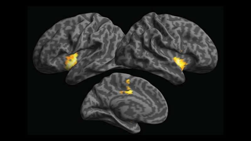 This shows brain scans from the study