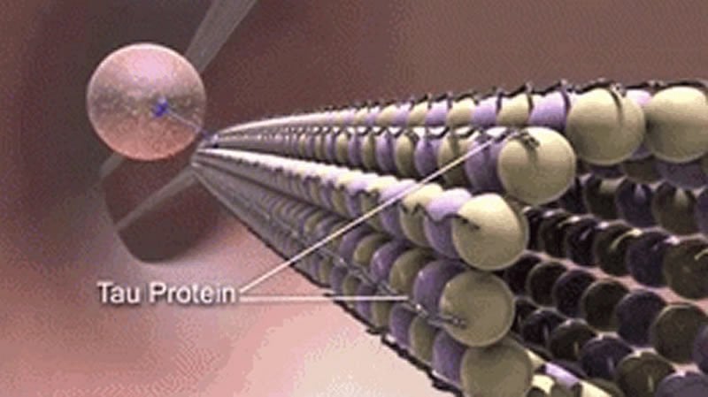 This is a drawing of the Tau protein