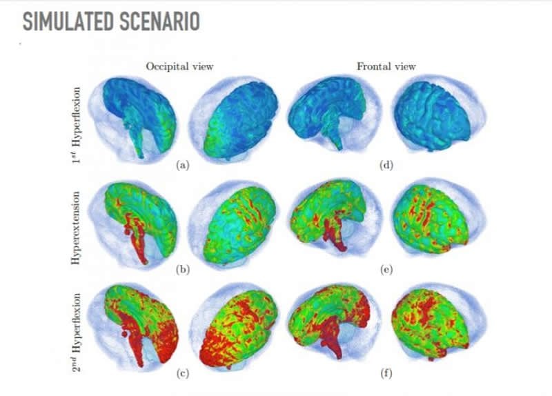 This shows brain scans