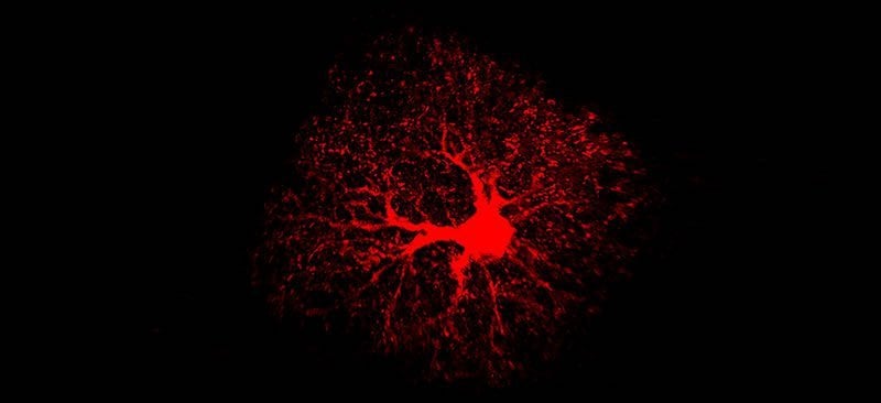 This shows an astrocyte