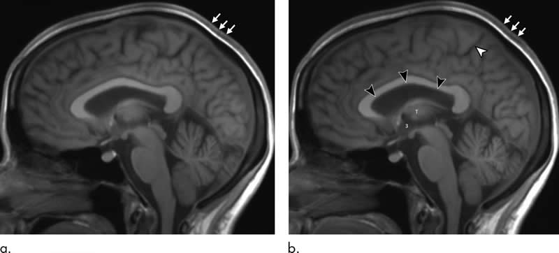 This shows brain scans