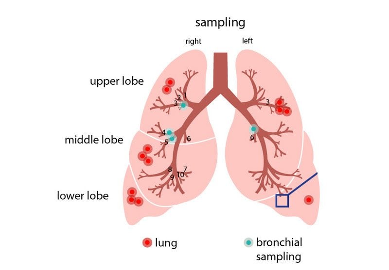 This is a diagram of the lungs