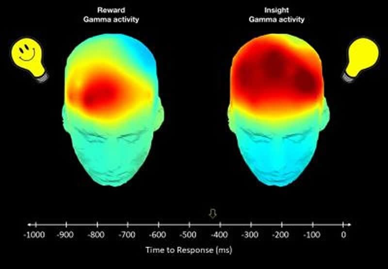 This shows the EEG readout