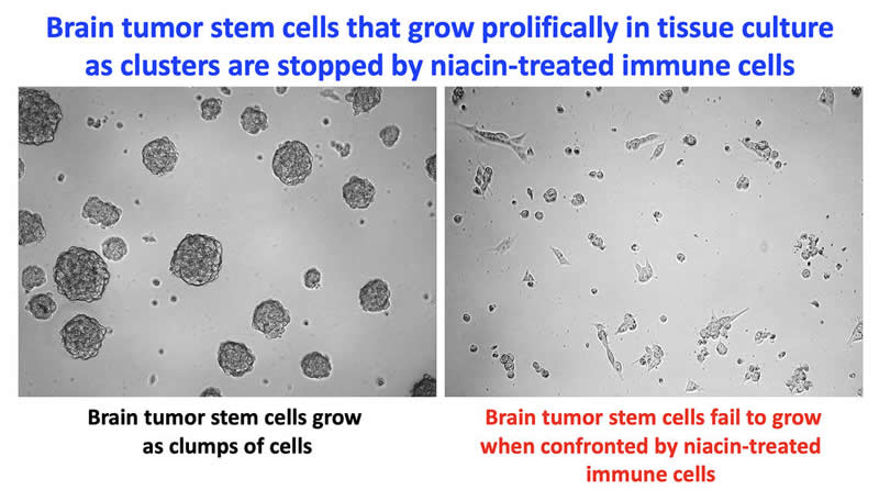 This shows immune cells