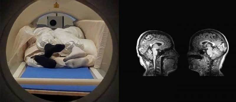 This shows the brain scans and the people cuddling in the mri