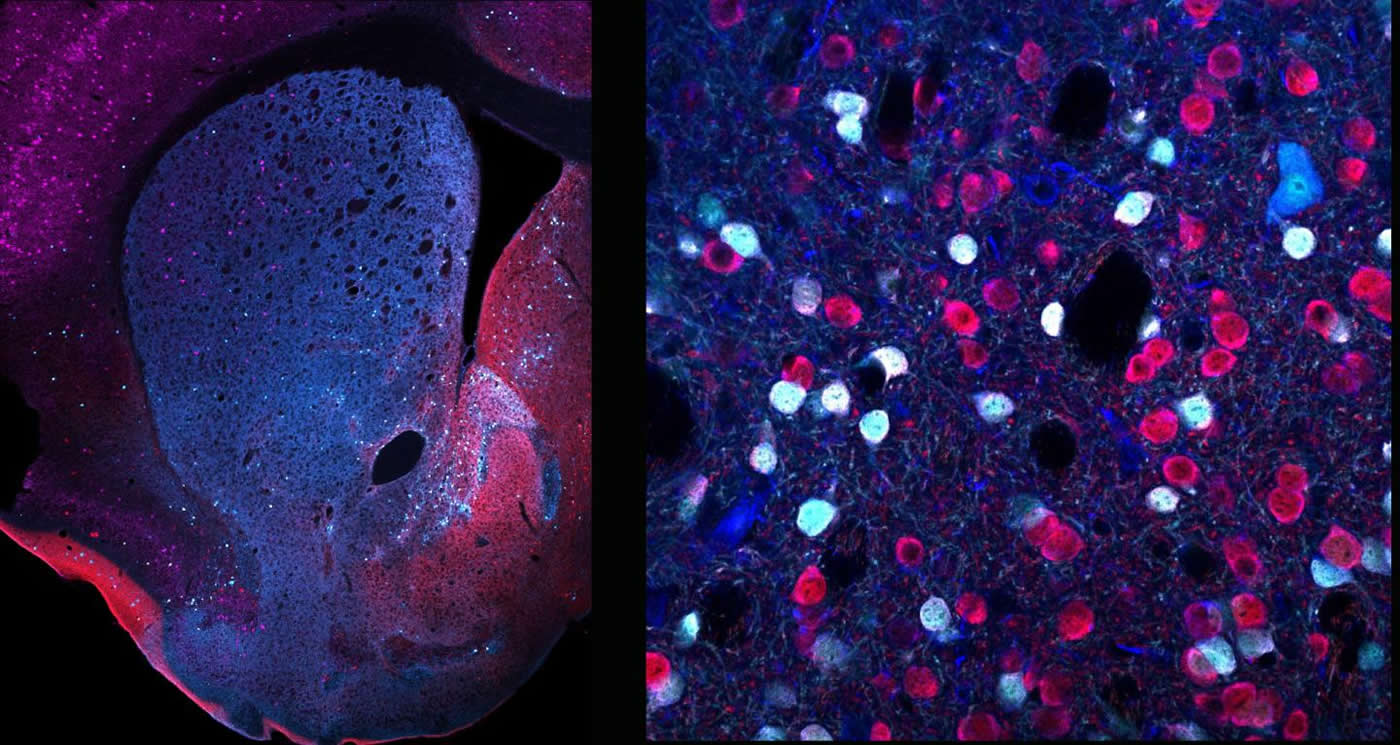 This shows different d2rs in the striatum