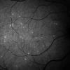 This shows retinal cells
