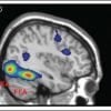 This shows the FFA on a brain scan