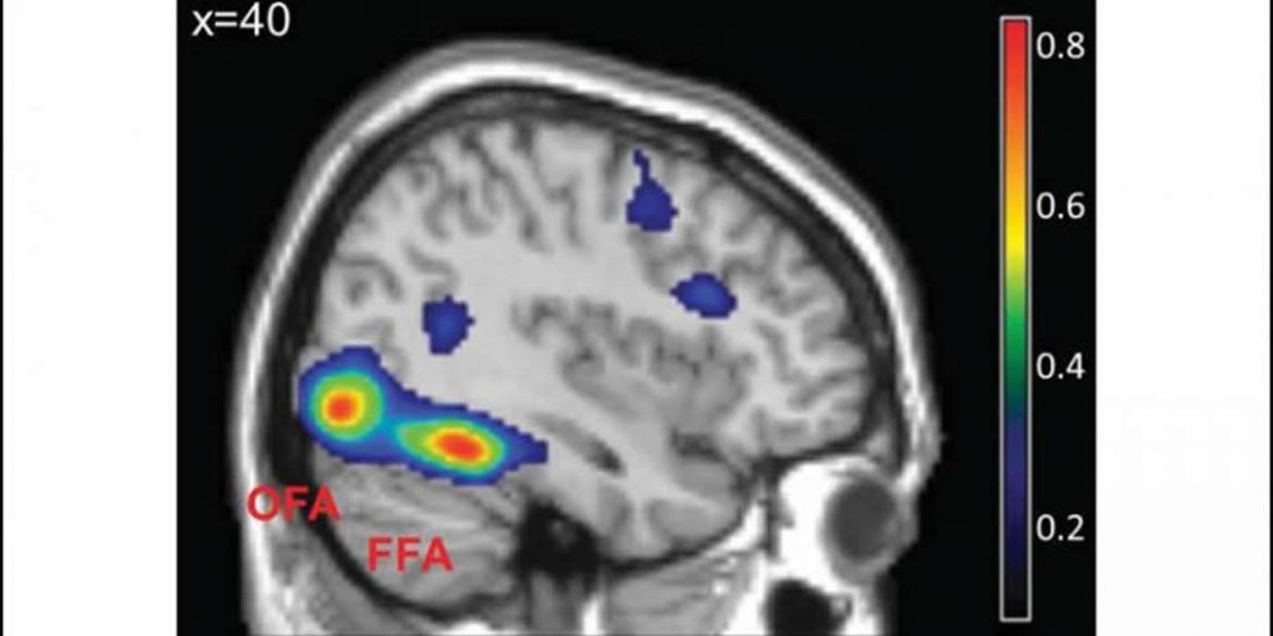 This shows the FFA on a brain scan