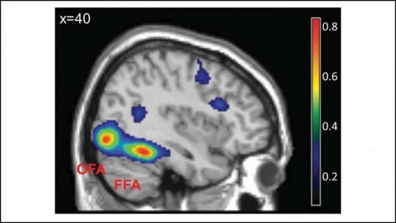 This shows the FFA on a brain scan