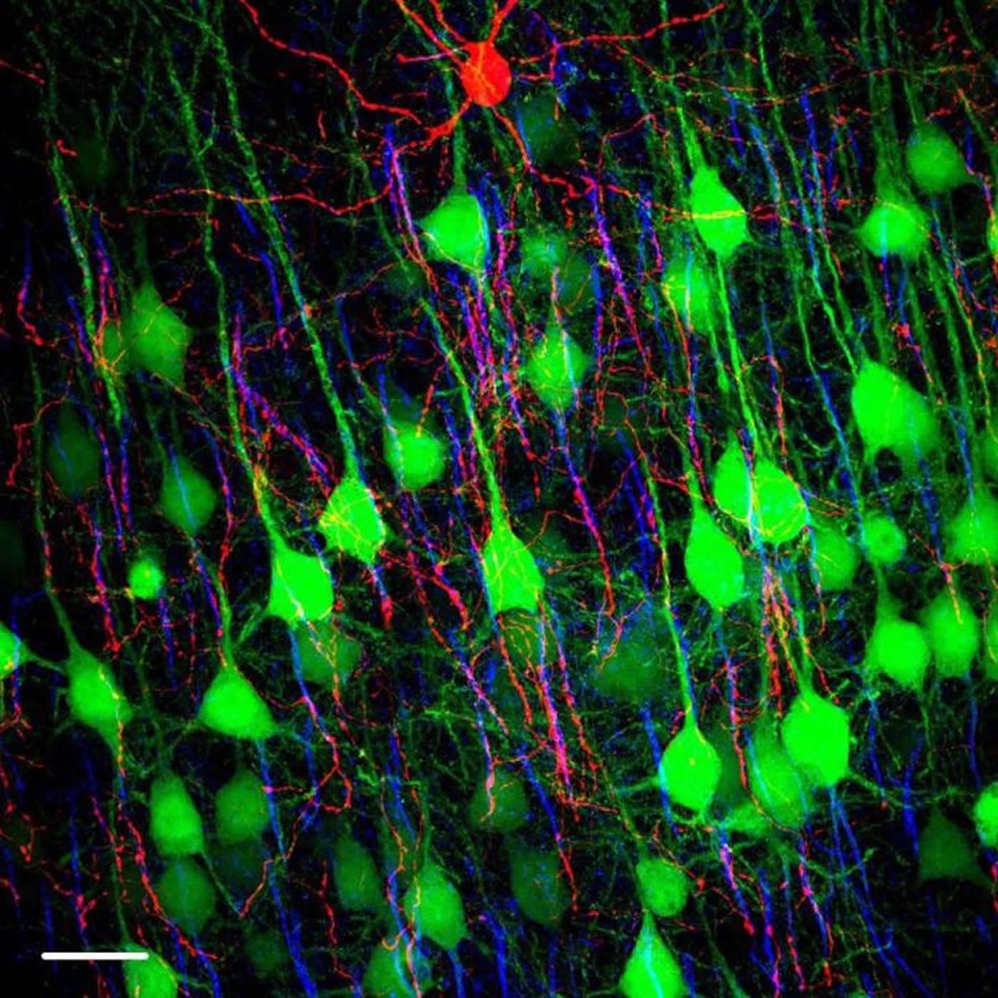 This shows chandelier cells