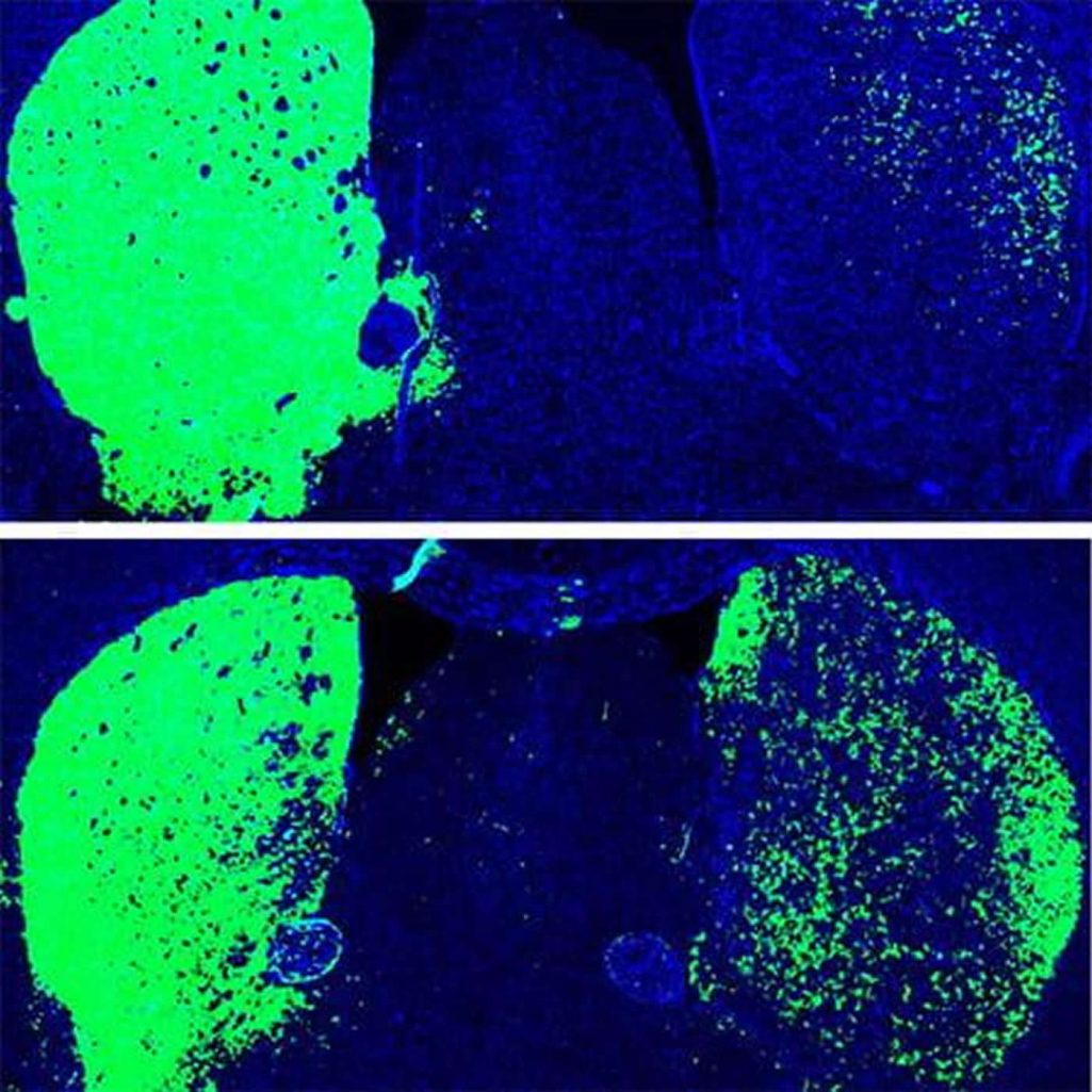 This shows dopamine neurons in the substantia nigra