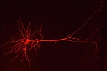 This shows a neuron