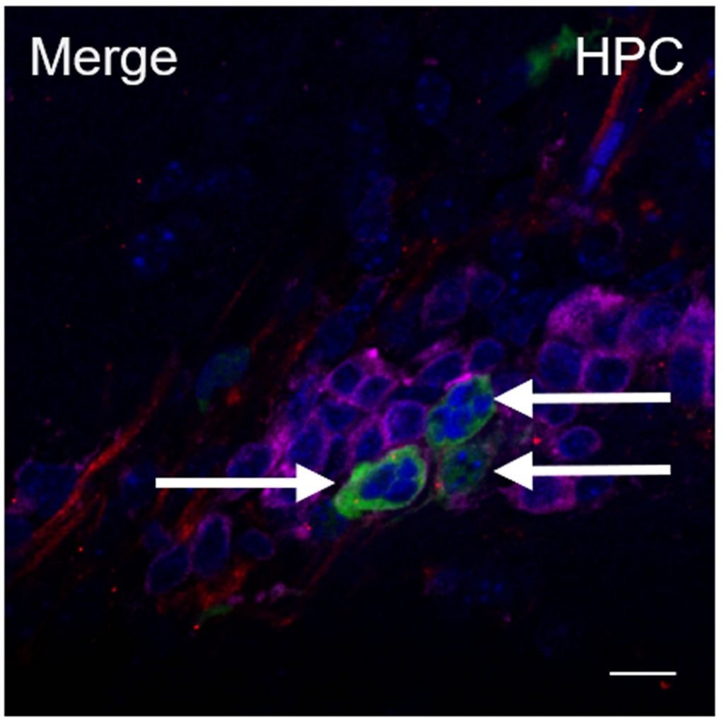 This shows astrocytes and t cells