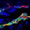 This shows blood vessels